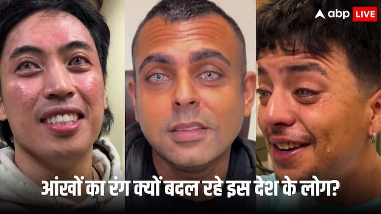 a new beauty trend of change eye colour takes over the united states of america surgery costs rs 10 lakh