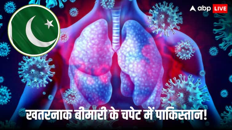 Pakistan Karachi Respiratory Diseases H1N1 Influenza Sindh Health Department alert Pakistan Karachi Respiratory Diseases H1N1 Influenza Sindh Health Department alert